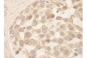 Immunohistochemistry (IHC) image for anti-SRSF Protein Kinase 1 (SRPK1) (AA 275-325) antibody (ABIN7448815)