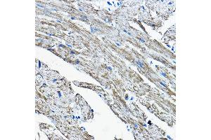 Immunohistochemistry of paraffin-embedded mouse heart using OGDHL Rabbit pAb (ABIN7269135) at dilution of 1:200 (40x lens). (OGDHL antibody  (AA 1-110))