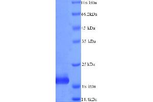 TIMP Metallopeptidase Inhibitor 4 (TIMP4) (AA 30-224), (full length) protein (His tag) (TIMP4 Protein (AA 30-224, full length) (His tag))