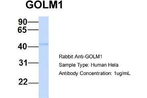 Host: Rabbit Target Name: GOLM1 Sample Type: Human Hela Antibody Dilution: 1. (GOLM1 antibody  (N-Term))
