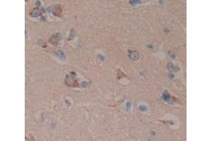 IHC-P analysis of Human Tissue, with DAB staining. (APLP1 antibody  (AA 62-202))