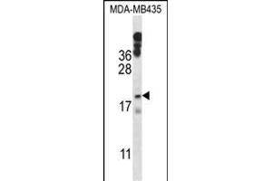 HIST1H1E Antibody (N-term) (ABIN657633 and ABIN2846629) western blot analysis in MDA-M cell line lysates (35 μg/lane).