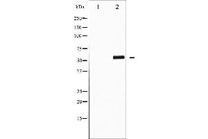 Western blot analysis of AFX phosphorylation expression in serum treated 293 whole cell lysates,The lane on the left is treated with the antigen-specific peptide.