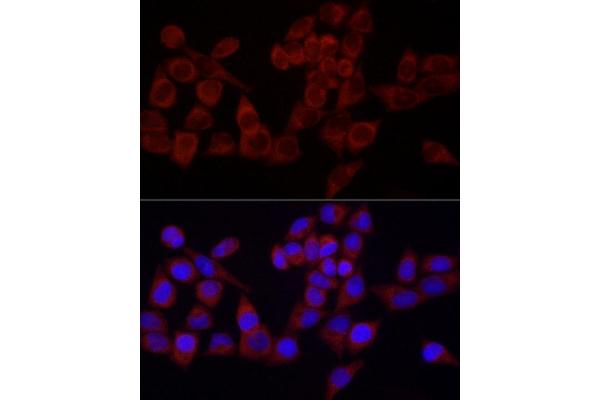 SRP72 antibody