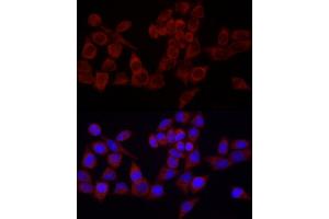 Immunofluorescence analysis of HeLa cells using SRP72 Rabbit pAb (ABIN6134166, ABIN6148452, ABIN7101299 and ABIN7101300) at dilution of 1:100 (40x lens). (SRP72 antibody)