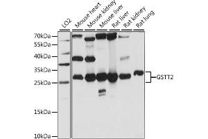 Western blot analysis of extracts of various cell lines, using GSTT2 antibody (ABIN7267449) at 1:1000 dilution. (GSTT2 antibody  (AA 1-244))