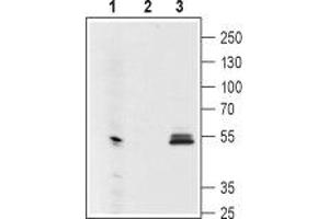 Western blot analysis using Mouse Anti-GIRK1 (Kir3. (KCNJ3 antibody  (Extracellular Loop))