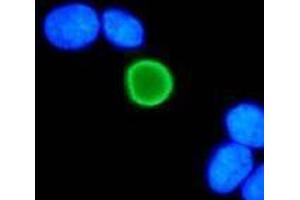 Immunofluorescence (IF) image for anti-Human Papilloma Virus 11 E7 (HPV-11 E7) (AA 1-35), (N-Term) antibody (ABIN781776) (Human Papilloma Virus 11 E7 (HPV-11 E7) (AA 1-35), (N-Term) antibody)