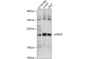 Western blot analysis of extracts of various cell lines, using NTPCR antibody (ABIN7269059) at 1:1000 dilution. (C1orf57 antibody  (AA 91-190))