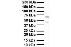 WB Suggested Anti-FOXA1 antibody Titration: 1 ug/mL Sample Type: Human liver (FOXA1 antibody  (C-Term))