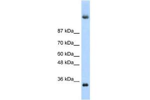 DAZ4 antibody used at 1 ug/ml to detect target protein.