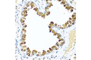 Immunohistochemistry of paraffin-embedded mouse lung using NRG4 antibody (ABIN3016309, ABIN3016310, ABIN3016311 and ABIN6219713) at dilution of 1:100 (40x lens). (Neuregulin 4 antibody  (AA 1-115))