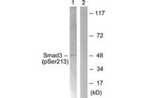 Western blot analysis of extracts from HT29 cells, using Smad3 (Phospho-Ser213) Antibody.