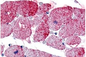 Human Heart (formalin-fixed, paraffin-embedded) stained with GPR175 antibody ABIN213352 at 10 ug/ml followed by biotinylated goat anti-rabbit IgG secondary antibody ABIN481713, alkaline phosphatase-streptavidin and chromogen. (GPR175 antibody  (Cytoplasmic Domain))