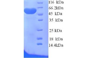 SDS-PAGE (SDS) image for Sulfite Oxidase (SUOX) (AA 1-416), (full length) protein (His tag) (ABIN5714478)