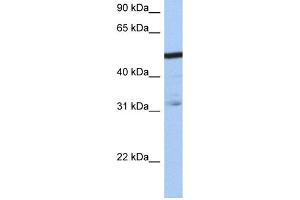 WB Suggested Anti-ZFAntibody Titration:  0. (ZFP14 antibody  (N-Term))
