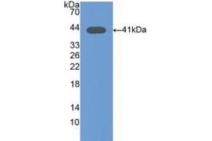 Detection of Recombinant Osteocalcin, Mouse using Polyclonal Antibody to Osteocalcin (OC) (Osteocalcin antibody  (AA 14-95))