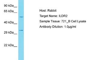 Host: Rabbit Target Name: ILDR2 Sample Tissue: Human 721_B Whole Cell Antibody Dilution: 1ug/ml (ILDR2 antibody  (C-Term))