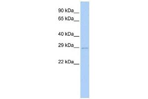UBE2S antibody used at 1 ug/ml to detect target protein. (UBE2S antibody  (N-Term))