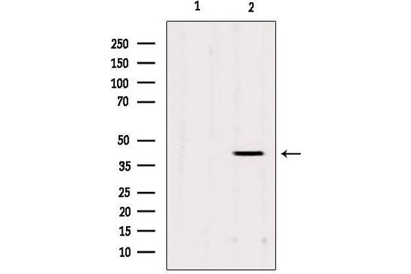 AGPAT3 antibody  (Internal Region)