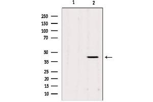 Western blot analysis of extracts from Mouse cancer, using AGPAT3 Antibody. (AGPAT3 antibody  (Internal Region))