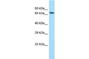 Host: Rabbit Target Name: ADCK2 Sample Type: Jurkat Whole Cell lysates Antibody Dilution: 1. (ADCK2 antibody  (Middle Region))