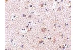 Immunohistochemistry (IHC) image for anti-Mesencephalic Astrocyte-Derived Neurotrophic Factor (MANF) (N-Term) antibody (ABIN1031449) (MANF antibody  (N-Term))