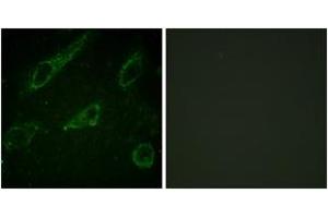 Immunofluorescence (IF) image for anti-C-Abl Oncogene 1, Non-Receptor tyrosine Kinase (ABL1) (AA 196-245), (pTyr245) antibody (ABIN1531424)