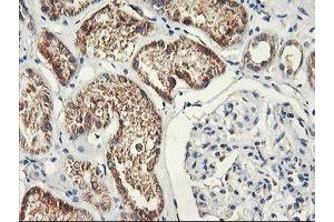 Immunohistochemical staining of paraffin-embedded Human Kidney tissue using anti-PDSS2 mouse monoclonal antibody. (PDSS2 antibody)
