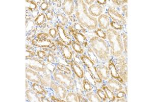 Immunohistochemistry of paraffin-embedded mouse kidney using MDH2 Rabbit mAb (ABIN7268381) at dilution of 1:25 (40x lens).