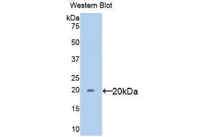 Detection of Recombinant gp130, Human using Polyclonal Antibody to Glycoprotein 130 (gp130) (CD130/gp130 antibody  (AA 392-566))