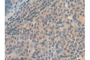 Detection of GDF10 in Human Stomach Tissue using Polyclonal Antibody to Growth Differentiation Factor 10 (GDF10) (GDF10 antibody  (AA 337-477))