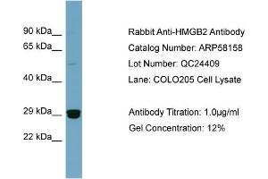 WB Suggested Anti-HMGB2  Antibody Titration: 0. (HMGB2 antibody  (Middle Region))