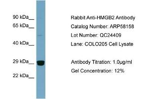 WB Suggested Anti-HMGB2  Antibody Titration: 0. (HMGB2 antibody  (Middle Region))