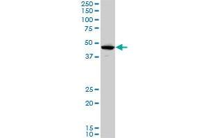 LHX5 monoclonal antibody (M05), clone 2B11. (LHX5 antibody  (AA 136-235))