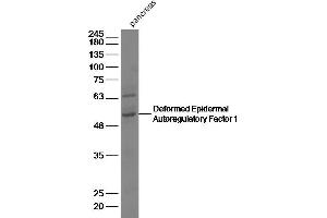 Mouse pancreas lysates, probed with Deformed Epidermal Autoregulatory Factor 1 Polyclonal Antibody, unconjugated (bs-6377R) at 1:2000 overnight at 4°C followed by a conjugated secondary antibody for 60 minutes at 37°C. (DEAF1 antibody  (AA 211-310))