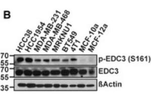 Western blot of Anti-EDC3 phospho S161 Antibody. (EDC3 antibody  (pSer161))