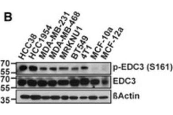 EDC3 antibody  (pSer161)