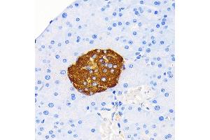 Immunohistochemistry (IHC) image for anti-Insulin (INS) antibody (ABIN7267886)