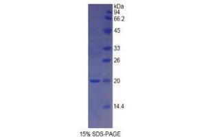 SDS-PAGE analysis of Rat GDF1 Protein. (GDF1 Protein)