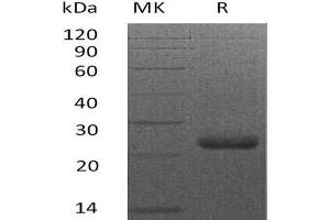 Western Blotting (WB) image for Syndecan 4 (SDC4) (AA 24-145) protein (His tag) (ABIN7320707) (SDC4 Protein (AA 24-145) (His tag))
