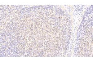 Detection of UBAP2 in Human Lymph node Tissue using Polyclonal Antibody to Ubiquitin Associated Protein 2 (UBAP2)