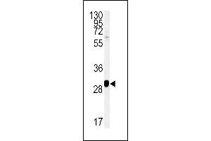 SC31B Antibody (C-term) (ABIN651805 and ABIN2840406) western blot analysis in NCI- cell line lysates (15 μg/lane).