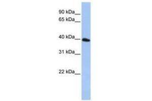 Image no. 1 for anti-Tetraspanin 17 (TSPAN17) (AA 72-121) antibody (ABIN6740790) (Tetraspanin 17 antibody  (AA 72-121))