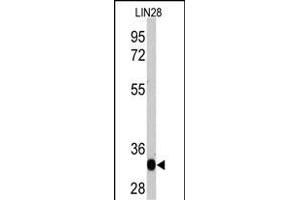 Western blot analysis of LIN28 recombinant protein by anti-LIN28A Monoclonal Antibody (ABIN387790 and ABIN2838026). (LIN28A antibody)