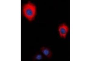 Immunofluorescent analysis of ZAP70 staining in HeLa cells. (ZAP70 antibody  (C-Term))
