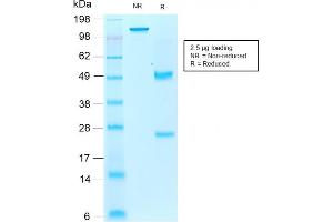SDS-PAGE Analysis Purified AIF1 / Iba1 Mouse Recombinant Monoclonal Antibody (rAIF1/1909). (Recombinant Iba1 antibody  (AA 1-146))