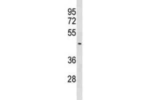 SUV39H2 antibody western blot analysis in MDA-MB453 lysate. (SUV39H2 antibody  (AA 367-395))
