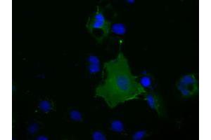 Image no. 3 for anti-Basigin (Ok Blood Group) (BSG) antibody (ABIN1498020) (CD147 antibody)