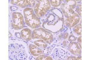 Immunohistochemistry of paraffin-embedded human kidney using MCL1 antibody (ABIN4904325) at dilution of 1:100 (40x lens).